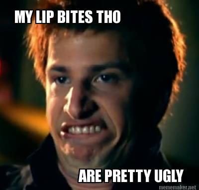 my-lip-bites-tho-are-pretty-ugly