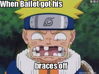 when-bailet-got-his-braces-off