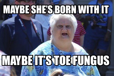 maybe-shes-born-with-it-maybe-its-toe-fungus