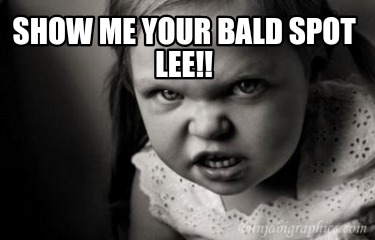 show-me-your-bald-spot-lee